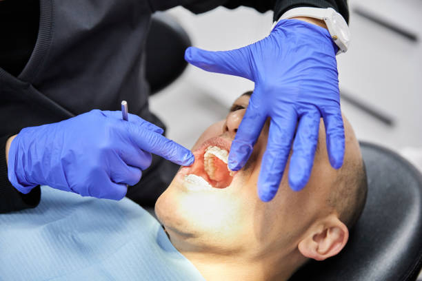 Best Teeth Whitening  in New Baden, IL